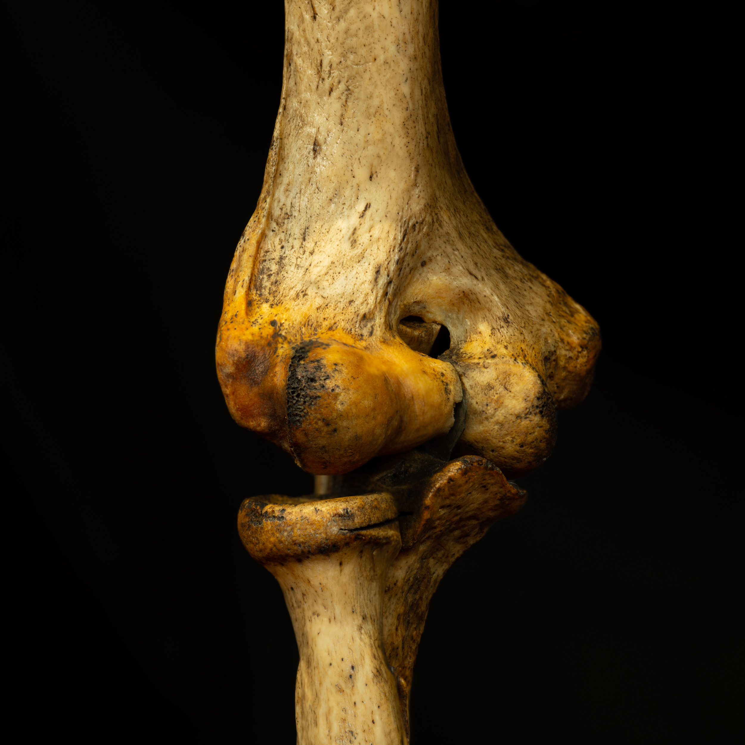 Close up detail shot of knee bone, colour on black background, there is black pitting on the joint