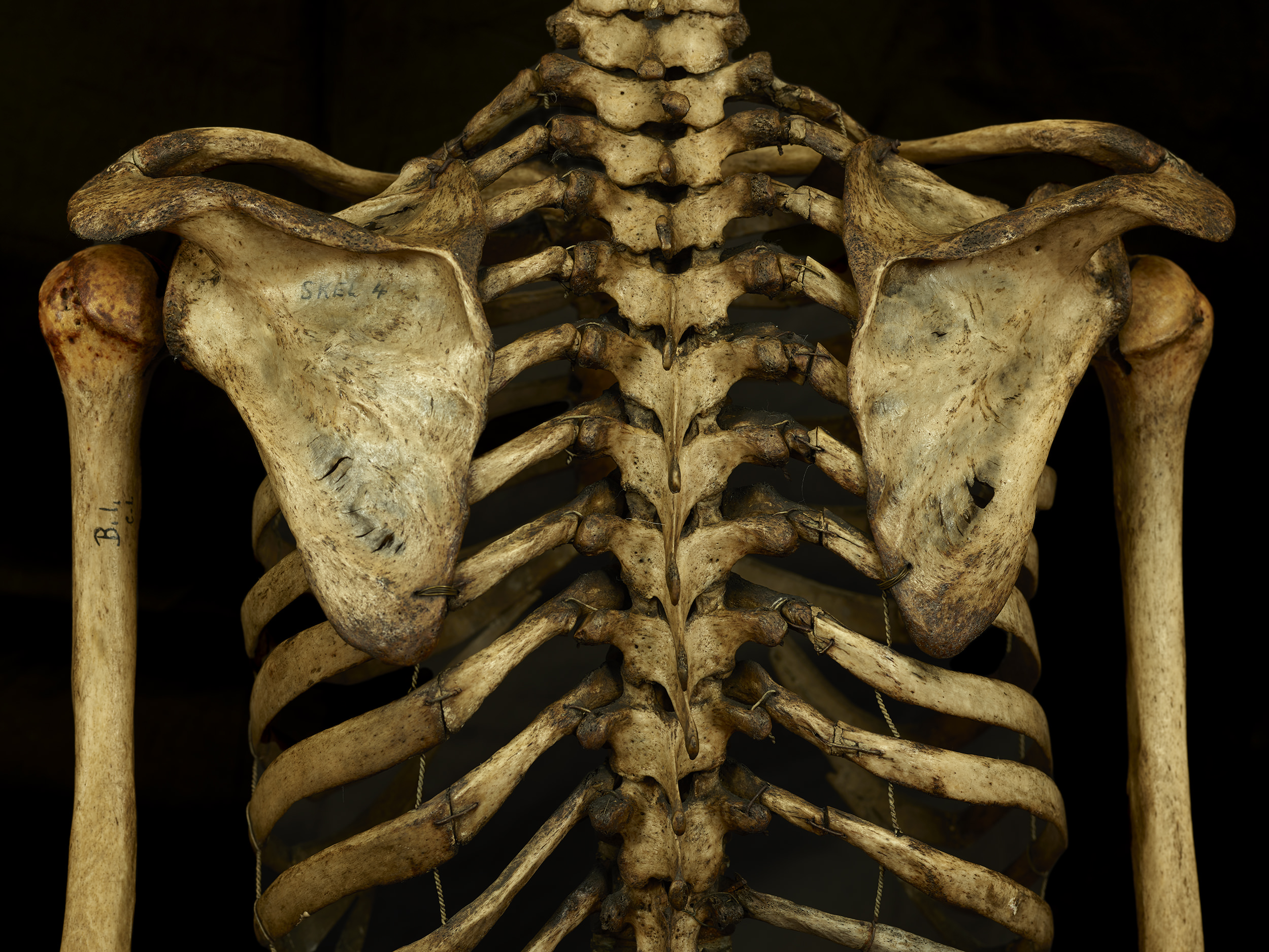 Colour photograph of an upper skeleton torso on a black background.
