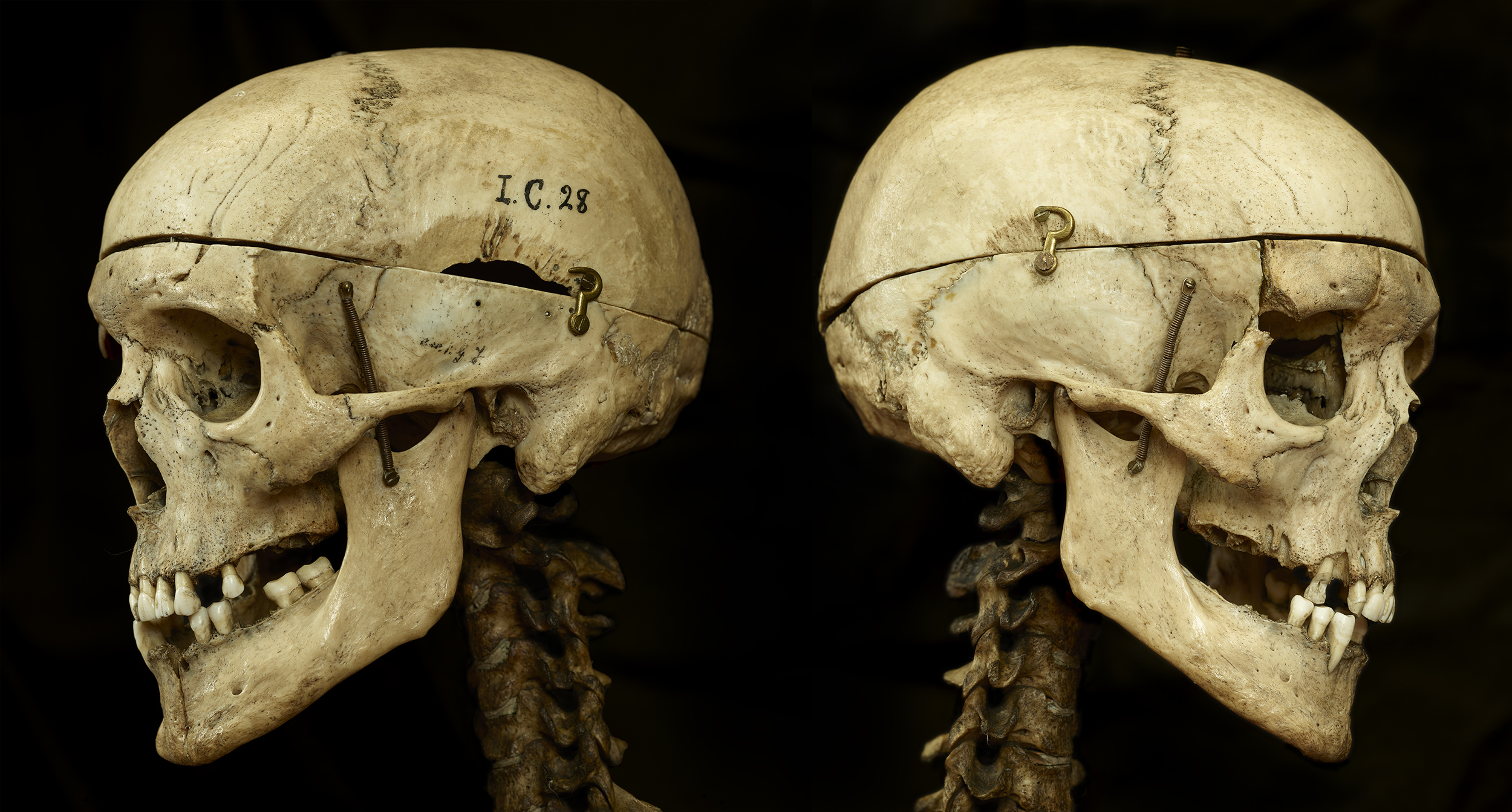 Landscape colour image of two skulls with spine attached on a black background. It is the same skull turned to the left and to the right, facing away from each other back to back.